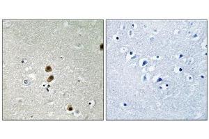 Immunohistochemical analysis of paraffin-embedded human brain tissue, using CtBP1 (Phospho-Ser422) antibody (left)or the same antibody preincubated with blocking peptide (right). (CTBP1 抗体  (pSer422))