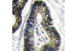 Image no. 1 for anti-Finkel-Biskis-Reilly Murine Sarcoma Virus (FBR-MuSV) Ubiquitously Expressed (FAU) (N-Term) antibody (ABIN357135) (FAU 抗体  (N-Term))