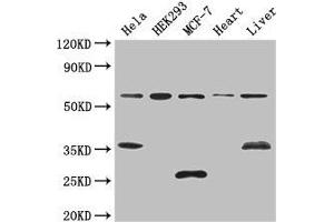 Western Blot Positive WB detected in: Hela whole cell lysate, HEK293 whole cell lysate, MCF-7 whole cell lysate, Mouse heart tissue, Mouse liver tissue All lanes: NCOA5 antibody at 3 μg/mL Secondary Goat polyclonal to rabbit IgG at 1/50000 dilution Predicted band size: 66 kDa Observed band size: 66, 35, 25 kDa (NCOA5 抗体  (AA 112-283))