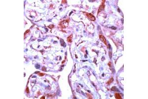 Immunohistochemical staining of human placenta stained with MMP1 polyclonal antibody  at 1 : 100 for 10 min at RT. (MMP1 抗体  (C-Term))