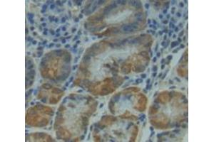 Used in DAB staining on fromalin fixed paraffin- embedded Kidney tissue (NUAK1 抗体  (AA 421-658))