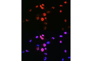 Immunofluorescence analysis of RD cells using MyoD1 Rabbit pAb (ABIN7268736) at dilution of 1:100 (40x lens).