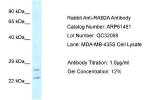 Western Blotting (WB) image for anti-RAB2A, Member RAS Oncogene Family (RAB2A) (C-Term) antibody (ABIN2774315) (RAB2A 抗体  (C-Term))