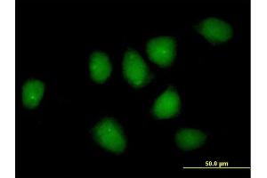 Immunofluorescence of purified MaxPab rabbit antibody to NR3C1 on HeLa cell. (Glucocorticoid Receptor 抗体  (AA 1-777))