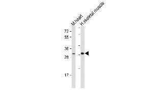 Western Blotting (WB) image for anti-Deiodinase, Iodothyronine, Type II (DIO2) (AA 165-191) antibody (ABIN652664)