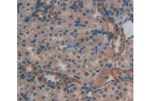 Immunohistochemistry (IHC) image for anti-Protein tyrosine Phosphatase, Receptor Type, A (PTPRA) (AA 618-796) antibody (ABIN5014195)