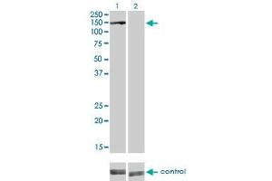 Western Blotting (WB) image for anti-Budding Uninhibited By Benzimidazoles 1 Homolog beta (Yeast) (BUB1B) (AA 1-130) antibody (ABIN560109)