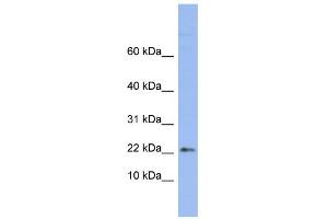 WB Suggested Anti-RPS24 Antibody Titration:  0. (RPS24 抗体  (Middle Region))