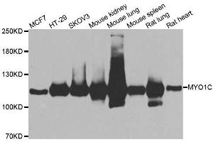 Western blot analysis of extracts of various cell lines, using MYO1C antibody. (Myosin IC 抗体  (AA 769-1028))
