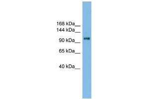 WB Suggested Anti-HK2 Antibody Titration: 0. (Hexokinase 2 抗体  (Middle Region))