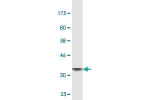 Western Blot detection against Immunogen (37. (ALPL 抗体  (AA 91-200))