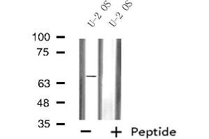Western Blotting (WB) image for anti-Solute Carrier Family 6 (Neurotransmitter Transporter, Dopamine), Member 3 (SLC6A3) (Internal Region) antibody (ABIN6257776)