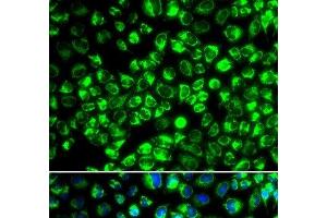 Immunofluorescence analysis of HeLa cells using ATP6AP2 Polyclonal Antibody (ATP6AP2 抗体)