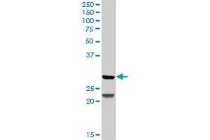 Western Blotting (WB) image for anti-Deoxycytidine Kinase (DCK) (AA 1-260) antibody (ABIN514893)