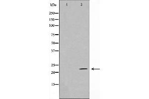 Western blot analysis on HeLa cell lysate using EFNA2 Antibody,The lane on the left is treated with the antigen-specific peptide.