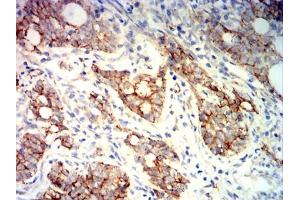 Immunohistochemistry (IHC) image for anti-Catenin (Cadherin-Associated Protein), beta 1, 88kDa (CTNNB1) (AA 632-781) antibody (ABIN7193682)