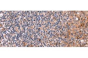 Immunohistochemistry of paraffin-embedded Human tonsil tissue using KLK9 Polyclonal Antibody at dilution of 1:50(x200) (Kallikrein 9 抗体)