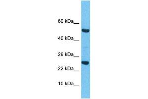 Western Blotting (WB) image for anti-Related RAS Viral (R-Ras) Oncogene Homolog 2 (RRAS2) (C-Term) antibody (ABIN2785767) (RRAS2 抗体  (C-Term))