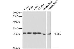 Western blot analysis of extracts of various cell lines using PRDX6 Polyclonal Antibody at dilution of 1:1000. (Peroxiredoxin 6 抗体)