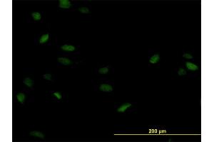 Immunofluorescence of monoclonal antibody to POLA2 on HeLa cell. (POLA2 抗体  (AA 1-598))