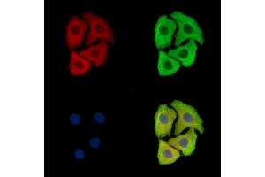 ABIN7097063 and ABIN7101130 staining Hela cells by IF/ICC. (FAM161B 抗体)