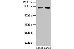 Western blot All lanes: MASP1 antibody at 6 μg/mL Lane 1: Hela whole cell lysate Lane 2: U251 whole cell lysate Secondary Goat polyclonal to rabbit IgG at 1/10000 dilution Predicted band size: 80, 82, 44, 69 kDa Observed band size: 80 kDa (MASP1 抗体  (AA 20-699))