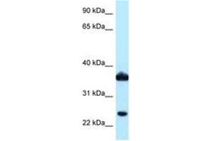 Image no. 1 for anti-Aldo-Keto Reductase Family 1, Member C3 (3-alpha Hydroxysteroid Dehydrogenase, Type II) (AKR1C3) (AA 97-146) antibody (ABIN6747883)