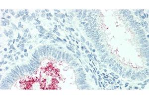 Immunohistochemistry of paraffin-embedded Human Uterus tissue using SLC34A2 Polyclonal Antibody at dilution of 1:60. (SLC34A2 抗体)