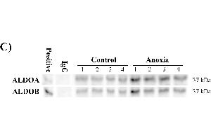 Aldolase purification and expression from the liver of control and anoxic turtles. (ALDOB 抗体)
