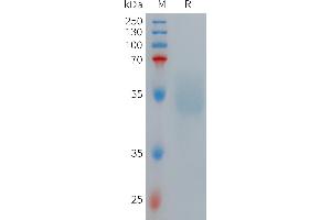 SDS-PAGE (SDS) image for Glucagon-Like Peptide 1 Receptor (GLP1R) (AA 24-139) protein (Fc Tag) (ABIN7491459)