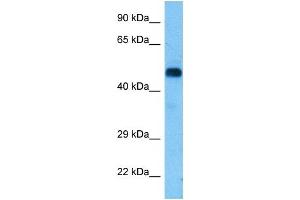 Host:  Rat  Target Name:  RIPK3  Sample Tissue:  Rat Brain  Antibody Dilution:  1ug/ml (RIPK3 抗体  (Middle Region))