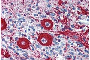 Human Brain, cerebellum: Formalin-Fixed, Paraffin-Embedded (FFPE) (VEZF1 抗体  (AA 288-337))