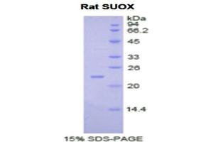 SDS-PAGE analysis of Rat Sulfite Oxidase Protein. (SUOX 蛋白)