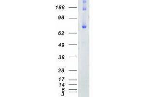 Validation with Western Blot