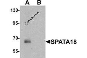 Western Blotting (WB) image for anti-Spermatogenesis Associated 18 (SPATA18) (N-Term) antibody (ABIN1031583) (SPATA18 抗体  (N-Term))