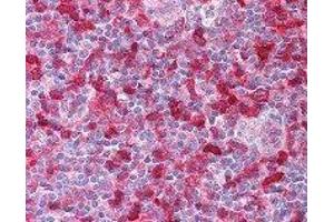 Immunohistochemistry (IHC) image for anti-Spleen tyrosine Kinase (SYK) (AA 5-360) antibody (ABIN2665374) (SYK 抗体  (AA 5-360))