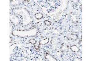 ABIN6266711 at 1/100 staining human kidney tissue sections by IHC-P. (AKAP8 抗体  (Internal Region))