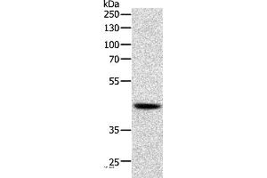 Western blot analysis of Human lymphoma tissue, using SOX7 Polyclonal Antibody at dilution of 1:750 (SOX7 抗体)