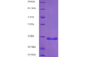 SDS-PAGE (SDS) image for EMI Domain Containing 1 (EMID1) (AA 678-751) protein (His-SUMO Tag) (ABIN5709167) (EMID1 Protein (AA 678-751) (His-SUMO Tag))