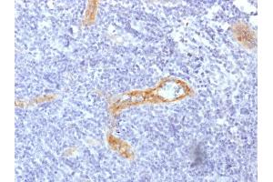 Formalin-fixed, paraffin-embedded human Tonsil stained with vWF Recombinant Mouse Monoclonal Antibody (rVWF/1465). (Recombinant VWF 抗体  (AA 1815-1939))