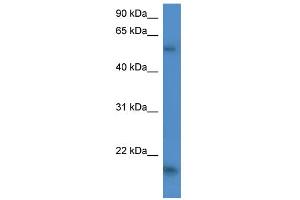 WB Suggested Anti-GPT2 Antibody Titration:  0. (GPT2 抗体  (C-Term))