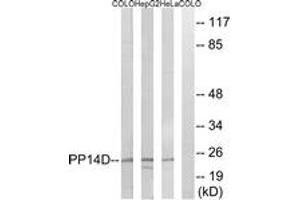 Western Blotting (WB) image for anti-Protein Phosphatase 1, Regulatory (Inhibitor) Subunit 14D (PPP1R14D) (AA 66-115) antibody (ABIN2890541) (PPP1R14D 抗体  (AA 66-115))