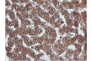 Immunohistochemical staining of paraffin-embedded Human liver tissue using anti-PDIA4 mouse monoclonal antibody. (PDIA4 抗体)