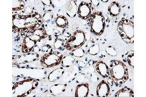 Immunohistochemistry (IHC) image for anti-Fumarylacetoacetate Hydrolase Domain Containing 2A (FAHD2A) antibody (ABIN1498183) (FAHD2A 抗体)