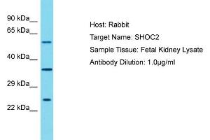 Host: Rabbit Target Name: SHOC2 Sample Tissue: Human Fetal Kidney Antibody Dilution: 1ug/ml (SHoc2/Sur8 抗体  (N-Term))