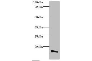 Western blot All lanes: Transmembrane protein 14B antibody at 2 μg/mL + K562 whole cell lysate Secondary Goat polyclonal to rabbit IgG at 1/10000 dilution Predicted band size: 13, 9 kDa Observed band size: 13 kDa (TMEM14B 抗体  (AA 1-114))