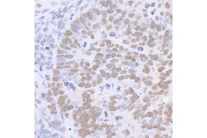 Immunohistochemistry (IHC) image for anti-Sp1 Transcription Factor (SP1) (C-Term) antibody (ABIN7458075) (SP1 抗体  (C-Term))