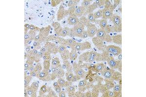 Immunohistochemistry of paraffin-embedded human liver injury using POMGNT1 antibody (ABIN6003611) at dilution of 1/100 (40x lens).