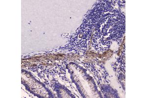 Immunohistochemistry (IHC) image for anti-Myosin Light Chain Kinase (MYLK) (AA 1441-1709) antibody (ABIN5693029)