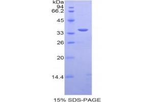 SDS-PAGE analysis of Human PST Protein. (SULT1A1 蛋白)